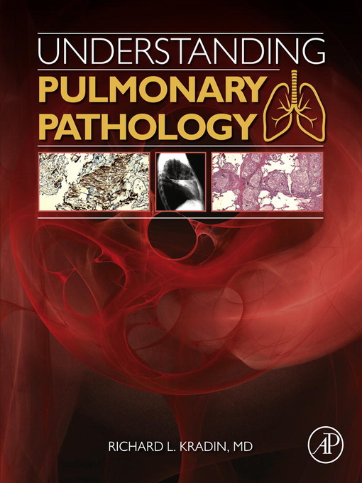 Title details for Understanding Pulmonary Pathology by Richard L. Kradin - Wait list